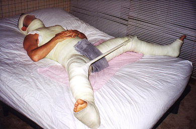 Oeps! Man in het gips